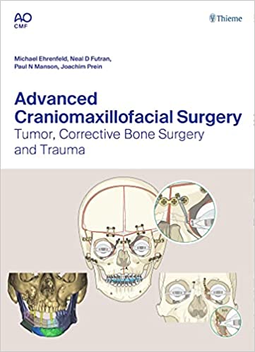 Advanced Craniomaxillofacial Surgery: Tumor, Corrective Bone Surgery, and Trauma 1st Edition