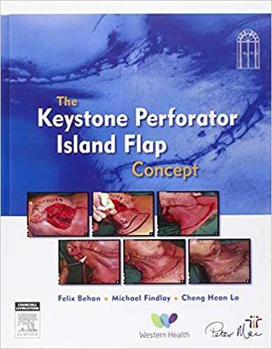 The Keystone Perforator Island Flap Concept 1st Edition