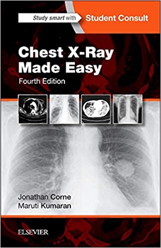 Chest X-Ray Made Easy 4th Edition (TRUE PDF &amp; EPUB)