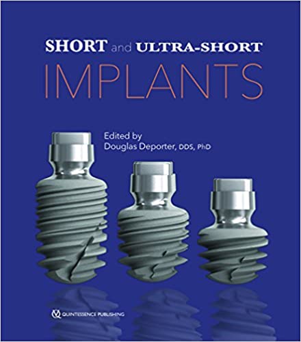 Short and Ultra-Short Implants 1st Edition