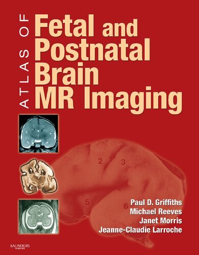 Atlas of Fetal and Postnatal Brain MR
