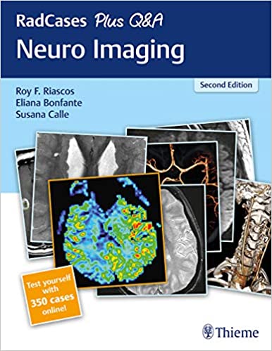 RadCases Plus Q&amp;A Neuro Imaging 2nd Edition