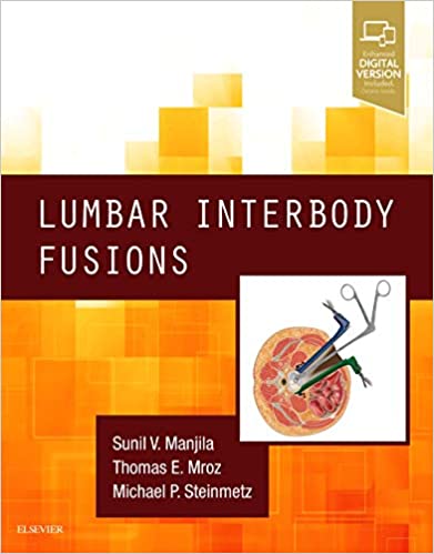 Lumbar Interbody Fusions 1st Edition