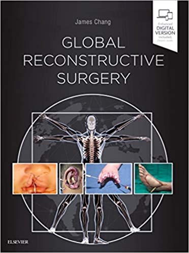 Global Reconstructive Surgery 1st Edition