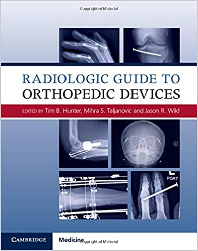 Radiologic Guide to Orthopedic Devices Illustrated Edition