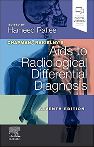 Chapman &amp; Nakielny's Aids to Radiological Differential Diagnosis 7th Edition (TRUE PDF)