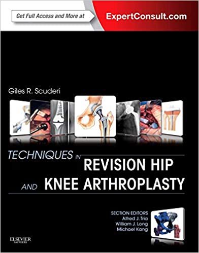 Techniques in Revision Hip and Knee Arthroplasty 1st Edition