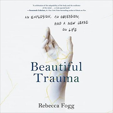 Beautiful Trauma: An Explosion, an Obsession, and a New Lease on LifeAudiobook