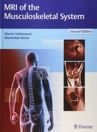 MRI of the Musculoskeletal System 2nd Edition