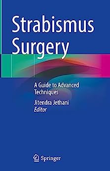 Strabismus Surgery: A Guide to Advanced Techniques