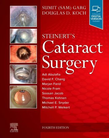 Steinert's Cataract Surgery 4th Edition (True PDF)
