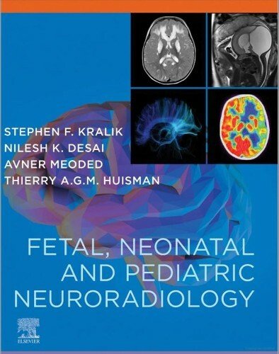 Fetal, Neonatal and Pediatric Neuroradiology